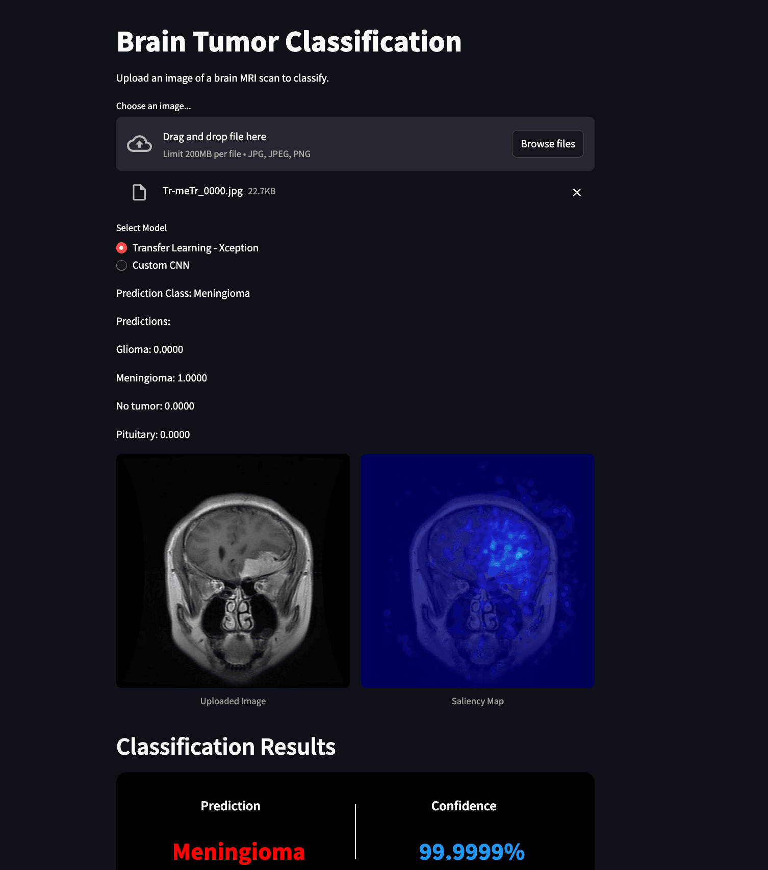 Brain Tumor Classification
